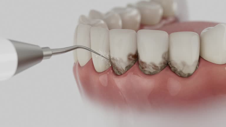 Reliable Dental contractor in Lincoln, CA by Smile Center Dentistry
